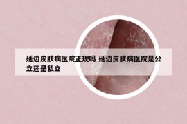 延边皮肤病医院正规吗 延边皮肤病医院是公立还是私立