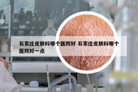 石家庄皮肤科哪个医院好 石家庄皮肤科哪个医院好一点