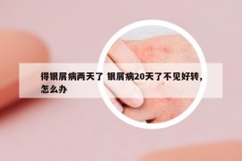 得银屑病两天了 银屑病20天了不见好转,怎么办