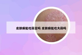 皮肤癣能吃蒜泥吗 皮肤癣能吃大蒜吗