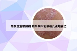 熬夜加重银屑病 银屑病不能熬夜几点睡合适