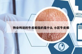 物业所说的牛皮癣指的是什么 小区牛皮癣
