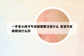 一岁多小孩子牛皮癣需要注意什么 宝宝牛皮肤癣涂什么药