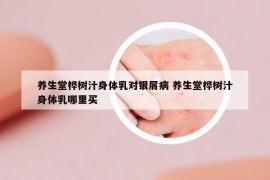 养生堂桦树汁身体乳对银屑病 养生堂桦树汁身体乳哪里买