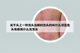 关于头上一种洗头治癣的洗头的叫什么深蓝色 头有癣用什么洗发水