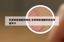 东营银屑病医院微信 东营银屑病医院微信号是多少