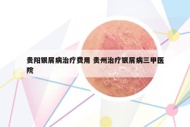 贵阳银屑病治疗费用 贵州治疗银屑病三甲医院