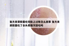 复方青黛胶囊吃完脸上过敏怎么回事 复方青黛胶囊吃了会头晕腹泻想吐吗