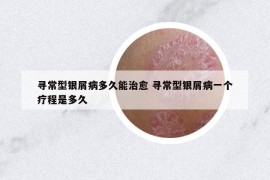 寻常型银屑病多久能治愈 寻常型银屑病一个疗程是多久