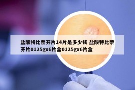 盐酸特比萘芬片14片是多少钱 盐酸特比萘芬片0125gx6片盒0125gx6片盒