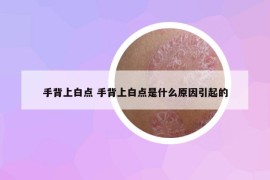 手背上白点 手背上白点是什么原因引起的