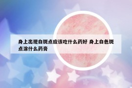 身上出现白斑点应该吃什么药好 身上白色斑点涂什么药膏