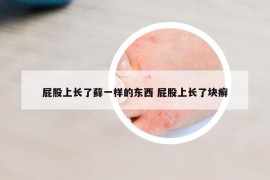 屁股上长了藓一样的东西 屁股上长了块癣