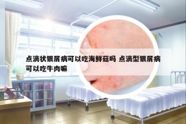 点滴状银屑病可以吃海鲜菇吗 点滴型银屑病可以吃牛肉嘛