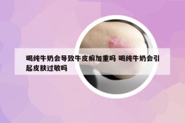 喝纯牛奶会导致牛皮癣加重吗 喝纯牛奶会引起皮肤过敏吗