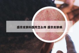 盛京皮肤科医院怎么样 盛京皮肤病