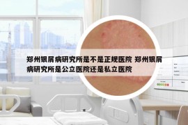 郑州银屑病研究所是不是正规医院 郑州银屑病研究所是公立医院还是私立医院