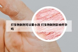 打生物制剂可以要小孩 打生物制剂影响怀孕吗