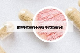 根除牛皮癣的小黄瓶 牛皮肤癣药水