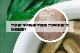 安徽治疗牛皮癣最好的医院 安徽哪里治疗皮肤病医院好