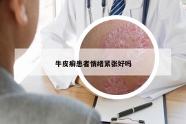 牛皮癣患者情绪紧张好吗