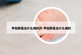 甲钴胺是治什么病的药 甲钴胺是治什么病的