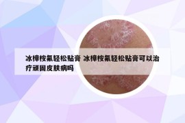 冰樟桉氟轻松贴膏 冰樟桉氟轻松贴膏可以治疗顽固皮肤病吗