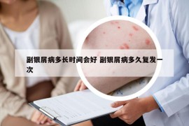 副银屑病多长时间会好 副银屑病多久复发一次