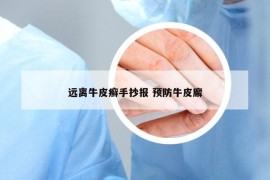 远离牛皮癣手抄报 预防牛皮廨