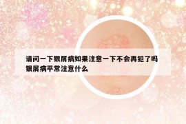 请问一下银屑病如果注意一下不会再犯了吗 银屑病平常注意什么
