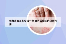 强力去癣王多少钱一合 强力去癣王的功效作用