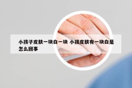 小孩子皮肤一块白一块 小孩皮肤有一块白是怎么回事