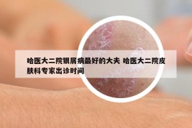 哈医大二院银屑病最好的大夫 哈医大二院皮肤科专家出诊时间