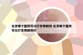 北京哪个医院可以打生物制剂 北京哪个医院可以打生物制剂针