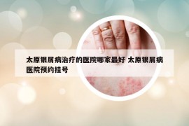 太原银屑病治疗的医院哪家最好 太原银屑病医院预约挂号