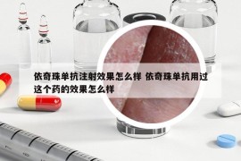 依奇珠单抗注射效果怎么样 依奇珠单抗用过这个药的效果怎么样