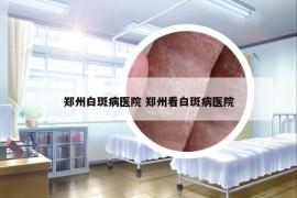 郑州白斑病医院 郑州看白斑病医院