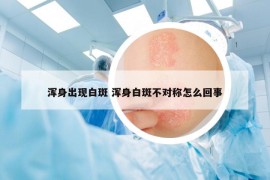 浑身出现白斑 浑身白斑不对称怎么回事