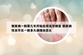 银屑病一般第几年开始出现关节病变 银屑病性关节炎一般多久病情会恶化