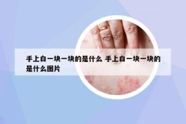 手上白一块一块的是什么 手上白一块一块的是什么图片