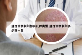 进口生物制剂都有几种类型 进口生物制剂多少钱一针