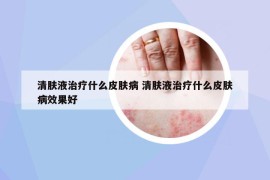 清肤液治疗什么皮肤病 清肤液治疗什么皮肤病效果好