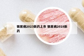 银屑病2023新药上市 银屑病2018新药