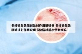 多烯磷脂酰胆碱注射作用说明书 多烯磷脂酰胆碱注射作用说明书价格以后小便会红吗