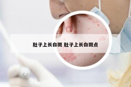 肚子上长白斑 肚子上长白斑点
