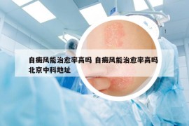 自癜风能治愈率高吗 自癜风能治愈率高吗 北京中科地址