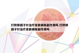 打转移因子针治疗皮肤病有副作用吗 打转移因子针治疗皮肤病有副作用吗