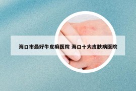 海口市最好牛皮癣医院 海口十大皮肤病医院
