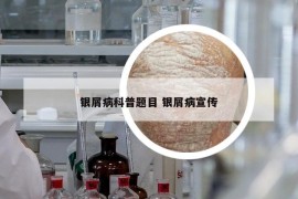 银屑病科普题目 银屑病宣传