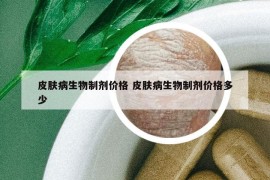 皮肤病生物制剂价格 皮肤病生物制剂价格多少